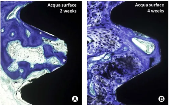 Figure 3. Sections of Acqua Ti implants and the surrounding tissue; A: after 2 weeks; B: after 4 weeks