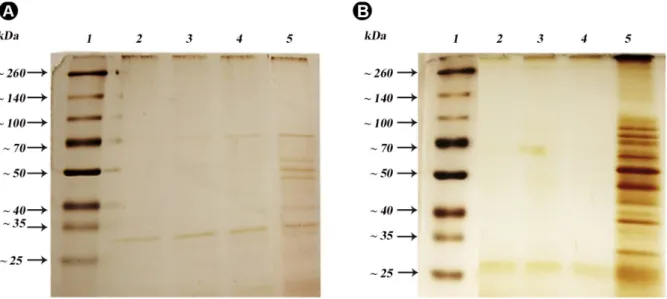 Figure 3. Total protein electrophoretic profile of P. gingivalis ATCC 33277 (A) and S