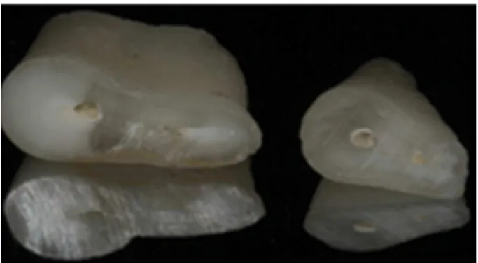 Figure 1. Cross section at 6 and 3 mm from the apex of the mesiobuccal  root of a maxillary first molar classified as type III (according to Weine’s  classification for canal configuration) and type II (according to Hsu and  Kim’s classification for isthmu