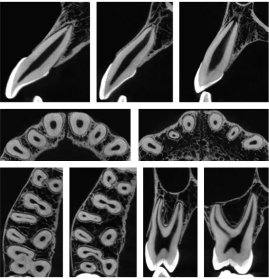 Figure 2. CBCT images of human maxillary incisors, canines, premolars and molars in different planes.