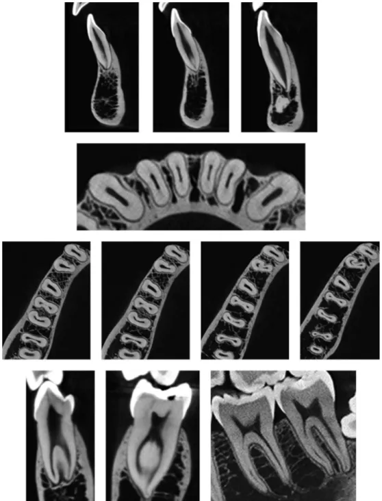 Figure 3. CBCT images of human mandibular incisors, canines, premolars and molars in different planes.