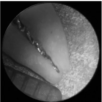 Figure 1. Image captured at 40× magnification presenting a specimen  after the preparation of root apex for the error measurement.