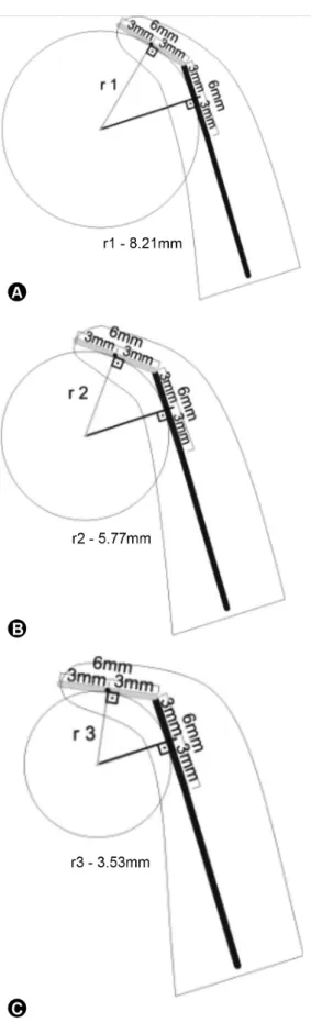 Figure 1. The root curvature radius based on 3 mathematical points  can be determined in both apical and coronal directions