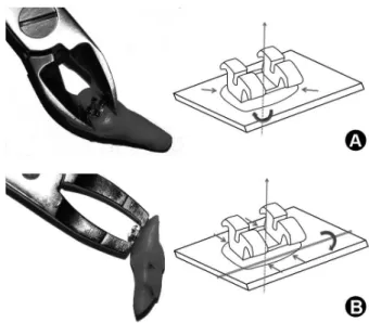 Figure 1. Positioning and forces generated by (A) SC and (B) ABR.