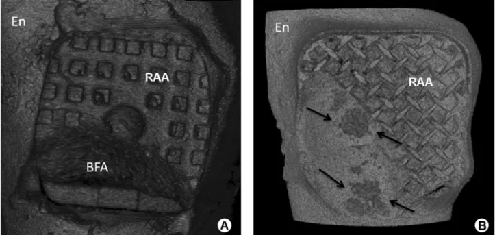 Figure 2. Images obtained for the measurement of variables. remaining adhesive area (RAA), enamel fracture area (arrows), bracket fragment Area  (BFA), Enamel (En).