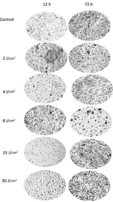 Figure 2. Panel of inverted microscope images representative of mineral deposition by SHEDs, 12 and 72 h after irradiation with infrared LED (850  nm) delivering different energy densities (0, 2, 4, 8, 15 and 30 J/cm 2 )