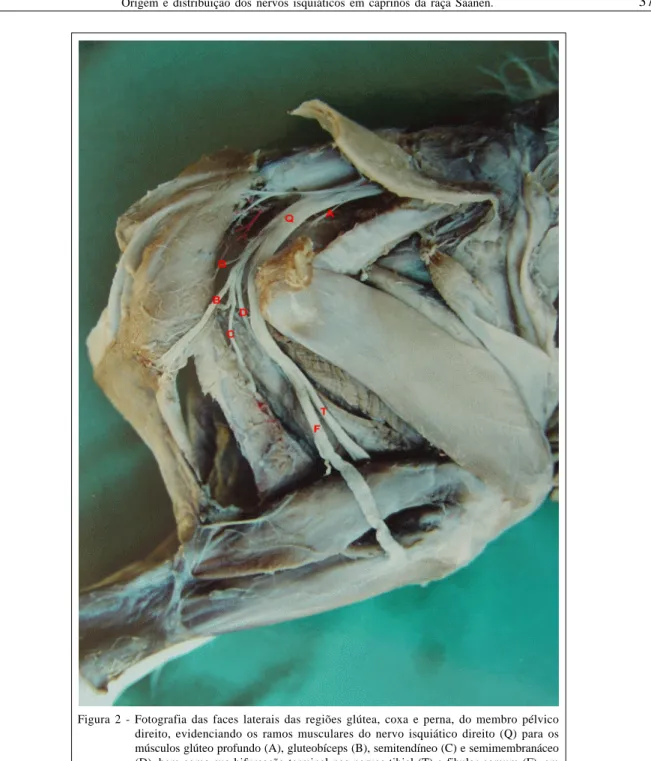 Figura 2 - Fotografia das faces laterais das regiões glútea, coxa e perna, do membro pélvico direito, evidenciando os ramos musculares do nervo isquiático direito (Q) para os músculos glúteo profundo (A), gluteobíceps (B), semitendíneo (C) e semimembranáce