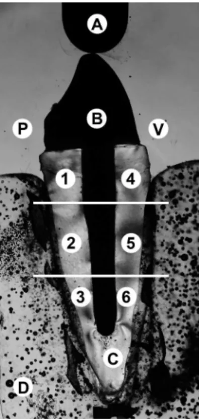 Figure 1. Photoelastic image of a cast metal post (B) under loading. 