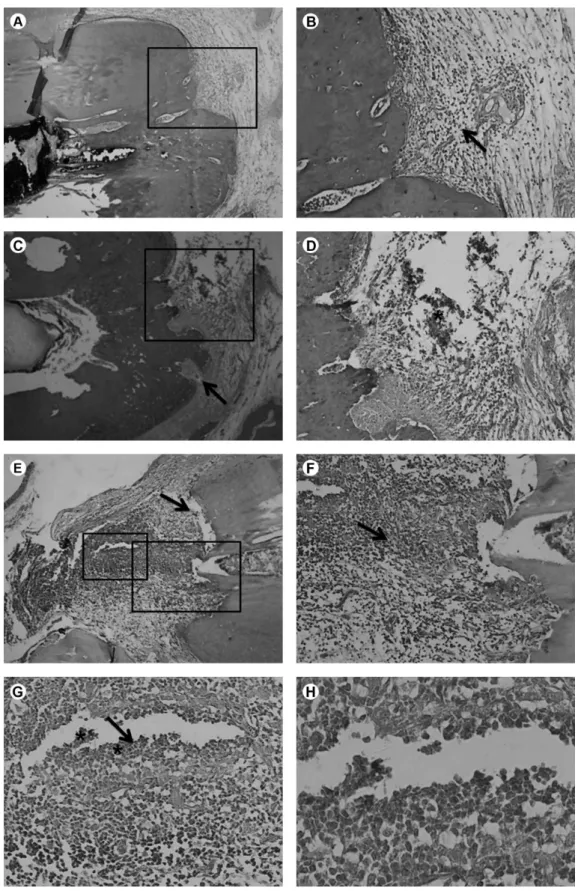 Figure 1. Composite figure showing the histopathological findings. A and B: images illustrating a score 1 from SX/PAD specimen (hematoxylin-eosin)