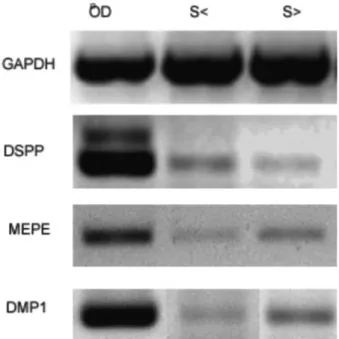 Figure 2. WST-1 analysis demonstrating the RCD rates produced on the  two scaffolds. Day 14 (p<0.05)
