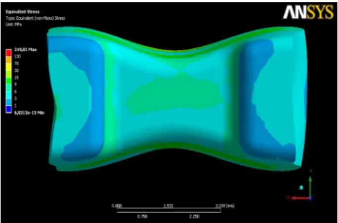 Figure 7. von Mises stress diagrams on internal surface of ceramic inlay  of numerical model restored with combination of 1mm-thick composite  resin with high elastic modulus and 2mm-thick ceramic inlay - R1C2c.