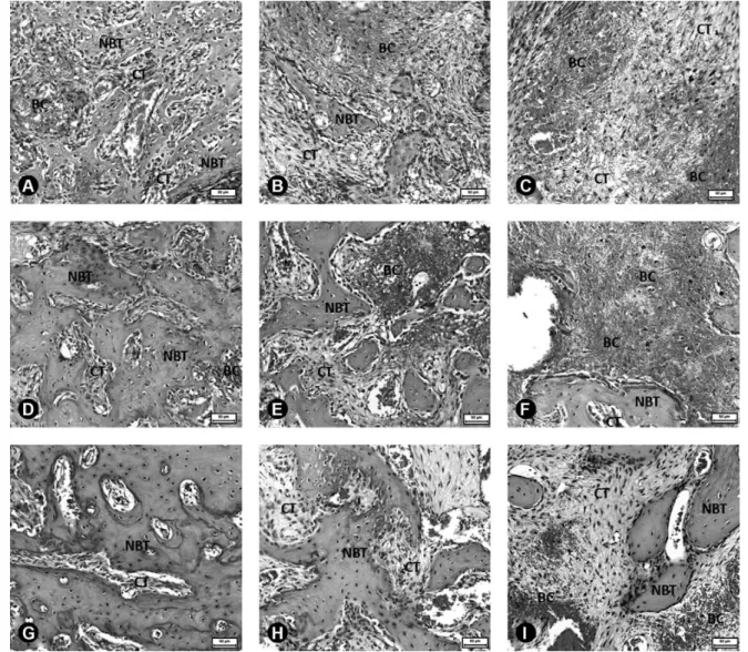 Figure 1. Histological aspects of bone repair after dental extraction in animals of control group (A, D and G); daily coffee intake group (B, E and H)  and intraperitoneal caffeine administration group (C, F and I) on days 7, 21 and 42 after surgical proce