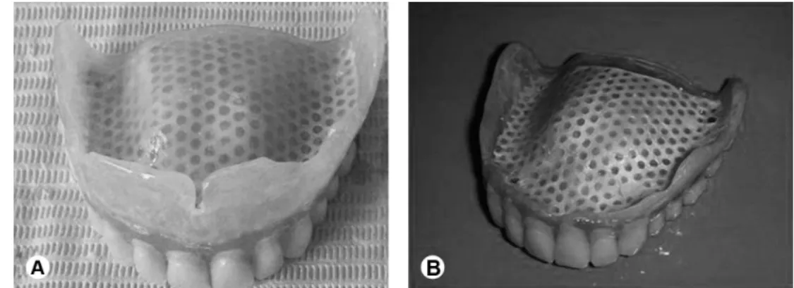 Figure 5. A: Control group: dentures with an intact base made according to the conventional method