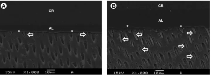 Figure 1. SEM micrographs of the resin-dentin interface bonded with the one-step self-etch mode (Fig