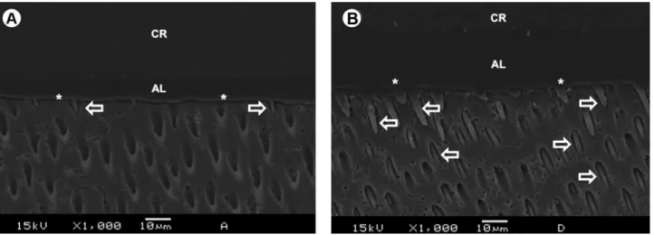 Figure 1. SEM micrographs of the resin-dentin interface bonded with the one-step self-etch mode (Fig