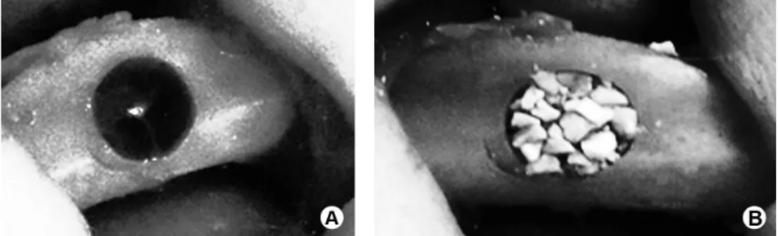 Figure 1. A: Clinical aspect of the surgical bone defect created on the right tibia of each animal