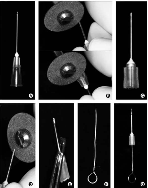 Figure 4. Modification of a 25-gauge injection needle to permit fragment removal in the case 2