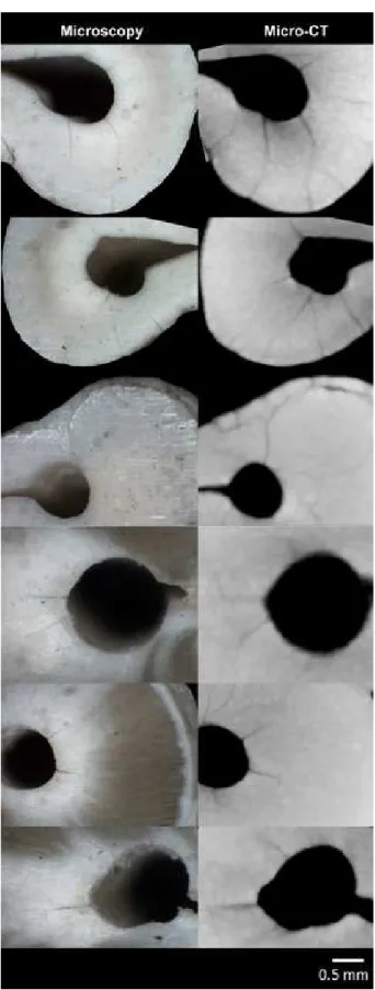Figure 2. Optical micrographs of cross-section images showing that  dentinal micro-cracks were fully identified through micro-CT  cross-sectional images.
