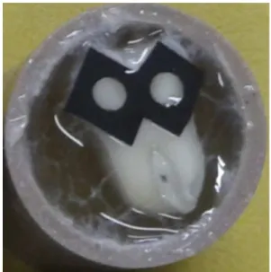 Figure 1. One human molar embedded in epoxi resin. Two delimited  dentin areas ( ∅ : 3 mm) per tooth were prepared