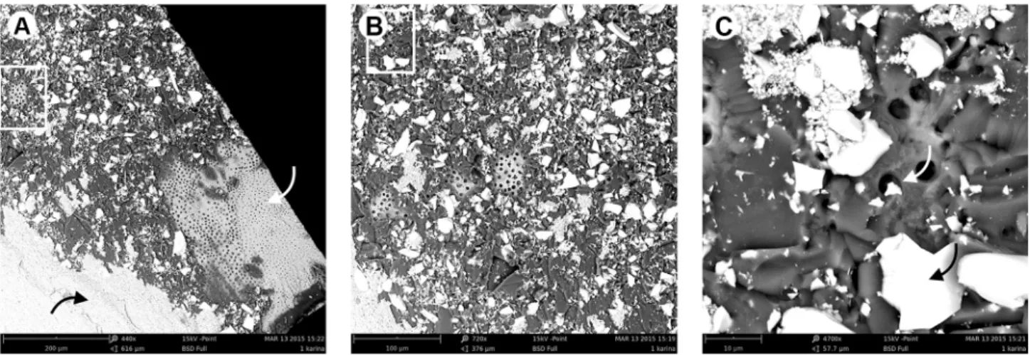 Figure 4. Representative specimen of PBNbGS group after six months: (A) SEM evaluation of mixed fracture with silanized NbG, exposure of  dentinal tubules (white arrow) and composite resin (black arrow)