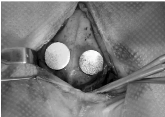 Figure 1. Surgical procedure for biomaterial implantation. Two  surgical defects were created using an 8-mm trephine bur, and the  nHA and nZnHA implants were adapted to the right and left receptor  beds, respectively