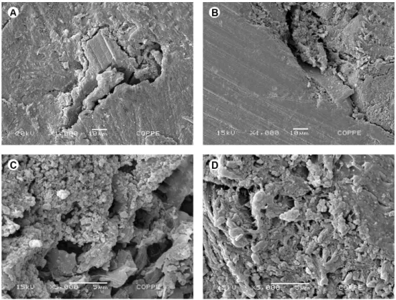 Figure 5. Scanning electron microscopy (SEM) after implantation of nHA (A and C) and nZnHA discs (B and D)