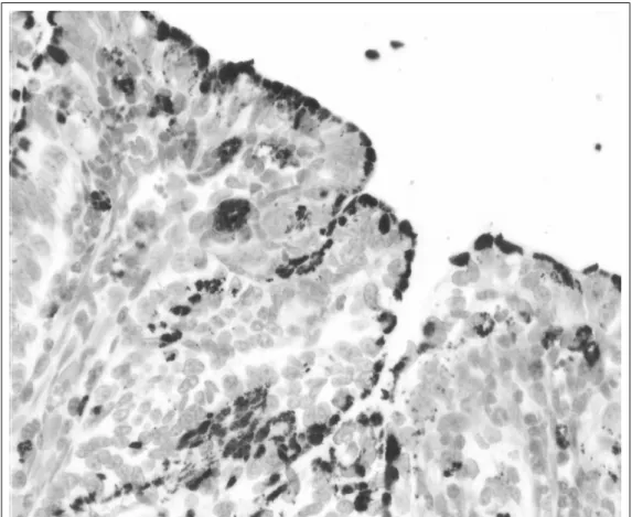 Figura 3 - Intensa marcação escura no citoplasma de enterócitos no ápice de vilosidades intestinais e no citoplasma de macrófagos isolados na lâmina própria