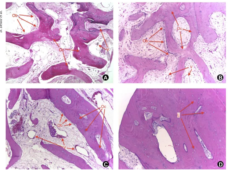 Figure 2. A, B and C: Healthy bone features with osteoblasts, osteocytes, vascular tissue and no inflammatory infiltrate (Ob: osteoblasts, Oc: 