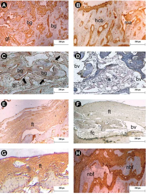 Figure 6. Immunopositivity for adiponectin. Panels A and B show, respectively, the pattern of adiponectin immunoexpression on the 2nd and 6th  week post-surgery in specimens treated with autograft, respectively