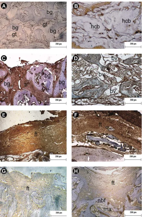 Figure 3. Immunopositivity for Erk1/2. Panels A and B show, respectively, the pattern of Erk1/2 immunoexpression on the 2nd and 6th week  post-surgery in specimens treated with autograft
