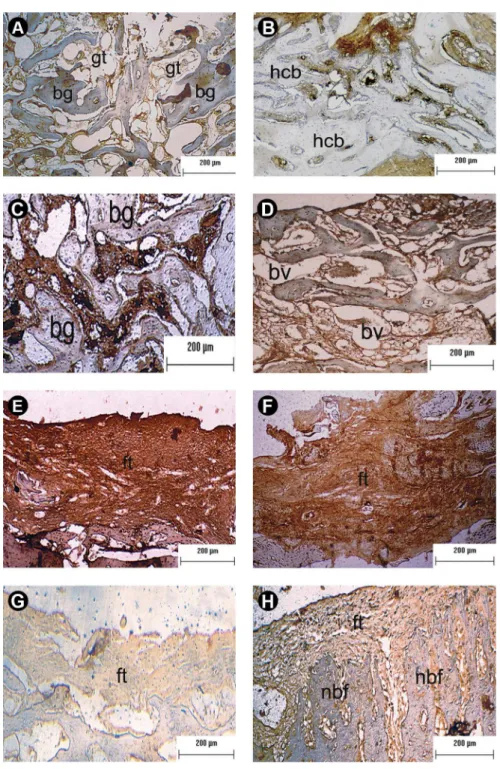 Figure 4. Immunopositivity for p38 α / β  Panels A and B show, respectively, the pattern of p38 α / β  immunoexpression on the 2nd and 6th week post- post-surgery in specimens treated with autograft, respectively