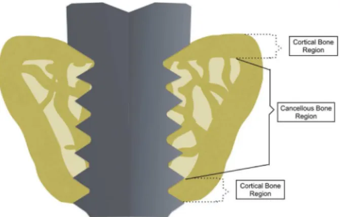 Figure 1. Schematic illustration representing the cortical and cancellous  bone regions evaluated separately for all the parameters.