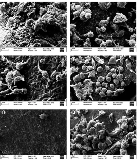 Figure 2. Attached fibroblasts cell of human dentin seem by SEM. (A) Control group, (B) root surface scaling and root planning, (C) citric acid,  (D) EDTA, (E) tetracycline capsule, and (F) tetracycline gel (Original magnification ×3000)