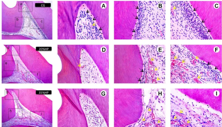 Figure 1. Representative images of H&amp;E-stained sections 2 days after bleaching. The three right panels in each row are magnified views (×400) of  the images (×100 magnification) from the CG (A-C), BLU (D-F) and MAX (G-I) groups