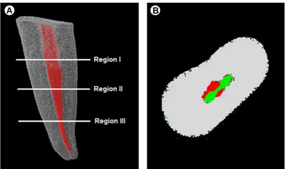 Figure 2. A: Regions used to calculate the porportion of instrumented area. B) Area pre (green) and post (red)  instrumentation
