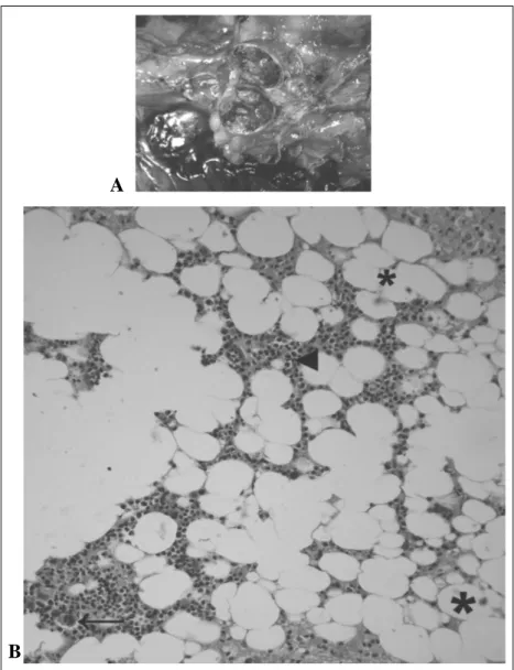 Figura 1 - Mielolipoma, glândula adrenal, cão. A) Superfície de corte vermelho-amarronzada entremeada por áreas lobulares amareladas, obliterando totalmente o tecido adrenal normal