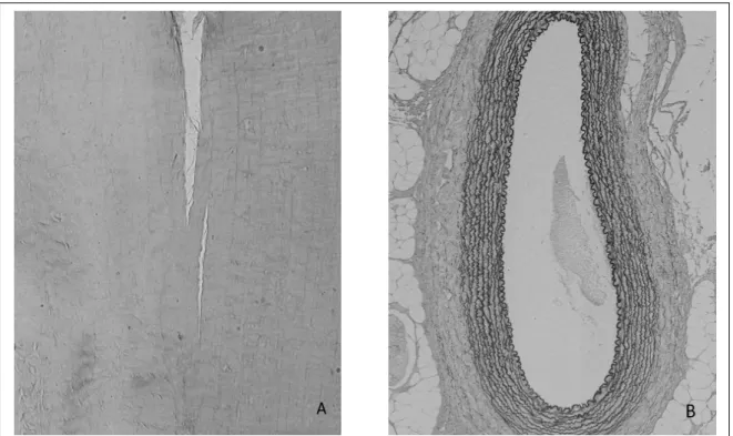Figura 1 - A - Fotomicrografia do ligamento colateral medial do cotovelo de cão em que não foram observadas fibras elásticas pela coloração de Weigert