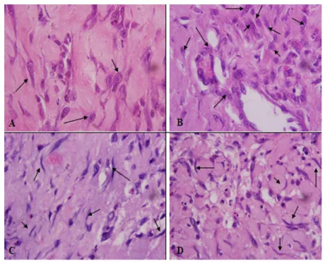 Figura 2 - Fotomicrografia de fibroblastos e fibrócitos na pele de coelhos. (A) e (B) Fibroblastos (setas) no 7 o  dia pós-incisão na pele de coelhos do grupo controle e tratados com calêndula respectivamente