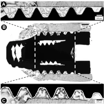 Figure 1. ROI (B) began below the first thread and finished at the last  thread. (A) ROI is delimited by black-line, and the BA in this region  is marked