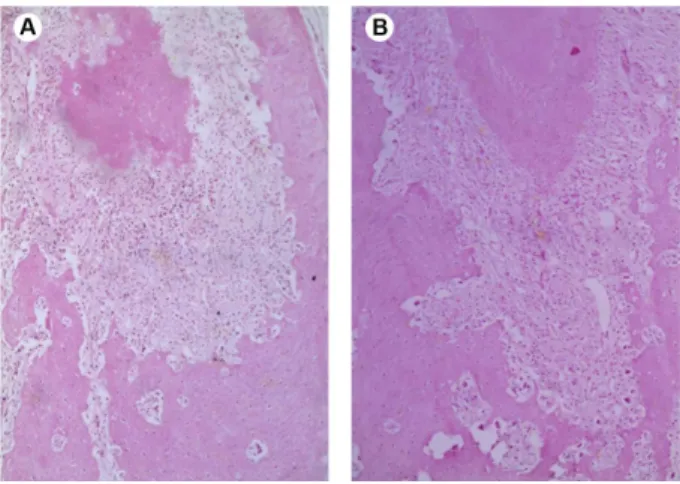 Figure 4. High-power field of periapical lesion in experimental group  G8. A: Fibrous connective tissue presenting mild chronic inflammatory  reaction, composed mainly by lymphocytes