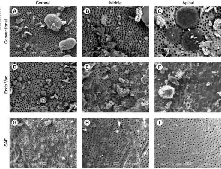 Figure 2. SEM micrographs representative of the different protocols and at each root canal third.