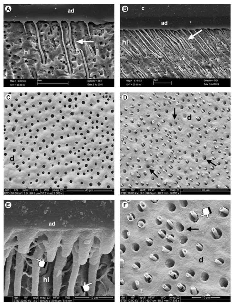 Figure 3. SEM images of dentin samples regarding hybrid layer formation in different locations