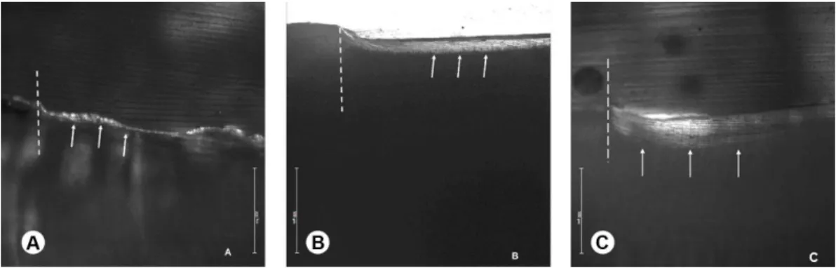 Figure 5. XRD patterns identifying the crystalline phases present in  the Biosilicate-treated specimens.