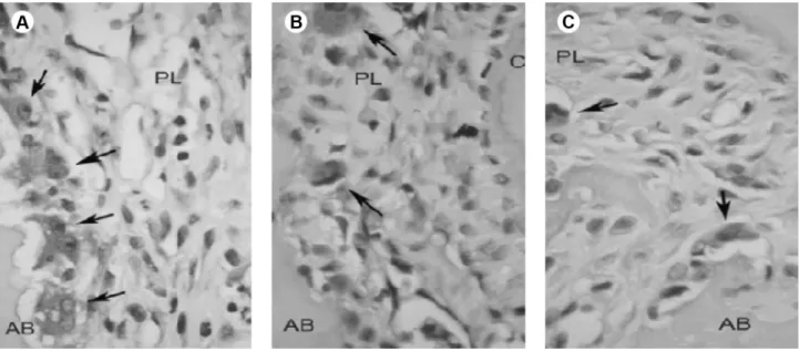 Figure 2. In the period of 3 days, a larger number of osteoclast cells (TRAP-positive cells, black arrows) were observed in group Deposteron  (A) and group Nebido (B) compared with the Control group (C)
