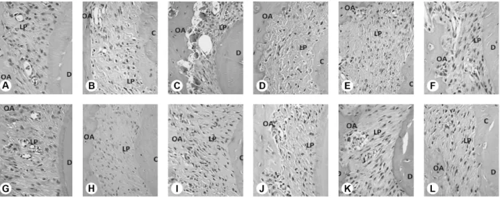 Figure 4. Deposteron experimental group. A, B, C, D, E: compression side of periodontal ligament at 0, 1, 3, 5, 7 and 14 days