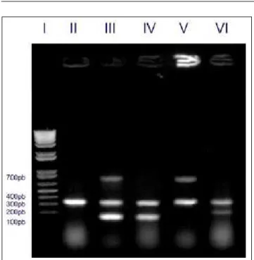 Figura 1 - Fotodocumentação de gel de agarose da PCR múltipla de material genético extraído de Clostridium perfringens  A-E