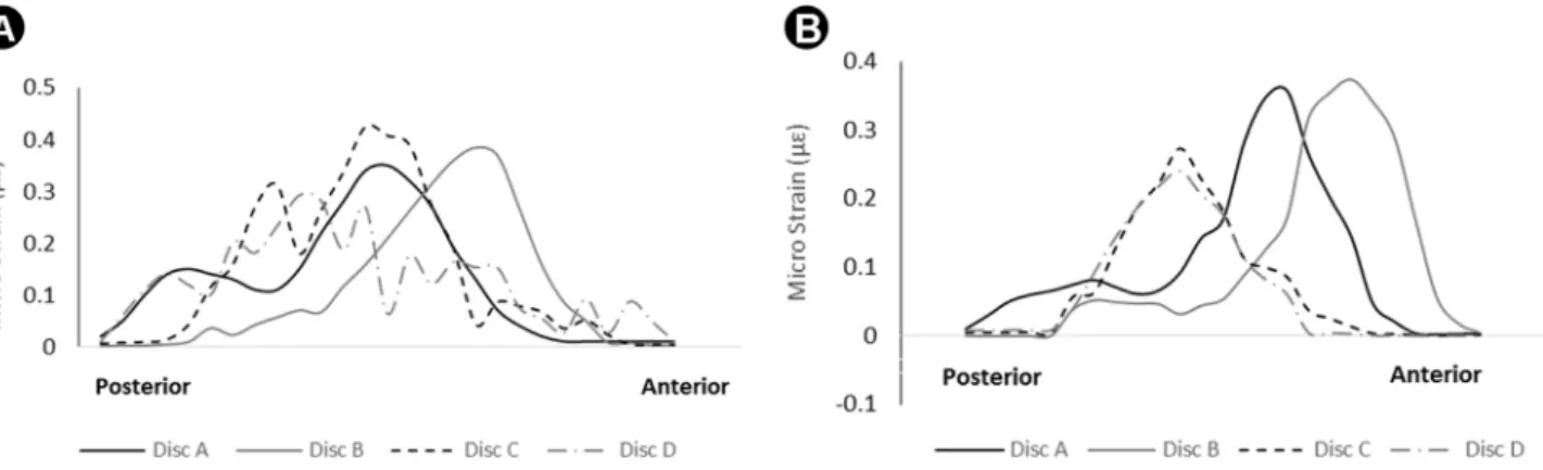 Figure 5. Equivalent of total strain distribution on the inferior (A) and superior (B) surfaces of the articular disc, after complete mandibular closure