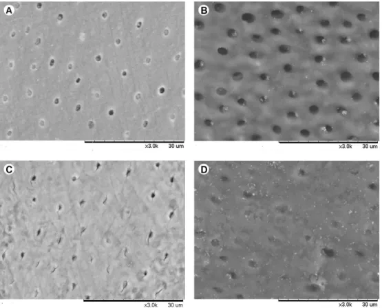 Figure 3. Electromicrographs of the UN and C3 groups (equivalent amount of cycles) before (A and B, respectively) and after (C and D) respectively)  the in situ stage