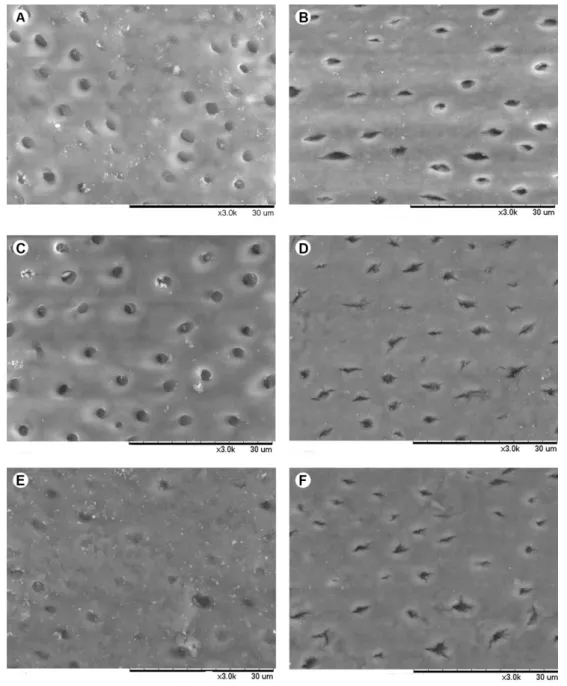 Figure 4. Electromicrographs of C1 (A), TiF 4 1 (B), C2 (C), TiF 4 2 (D), C3 (E) and TiF 4 3 (F) groups after the in situ stage