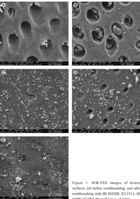 Figure 1. SEM-FEG images of dentin  surfaces: (A) before toothbrushing, and after  toothbrushing with (B) WATER; (C) CT12; (D)  CSPR; (E) SRP